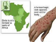 New Type of Ebola Virus identified 